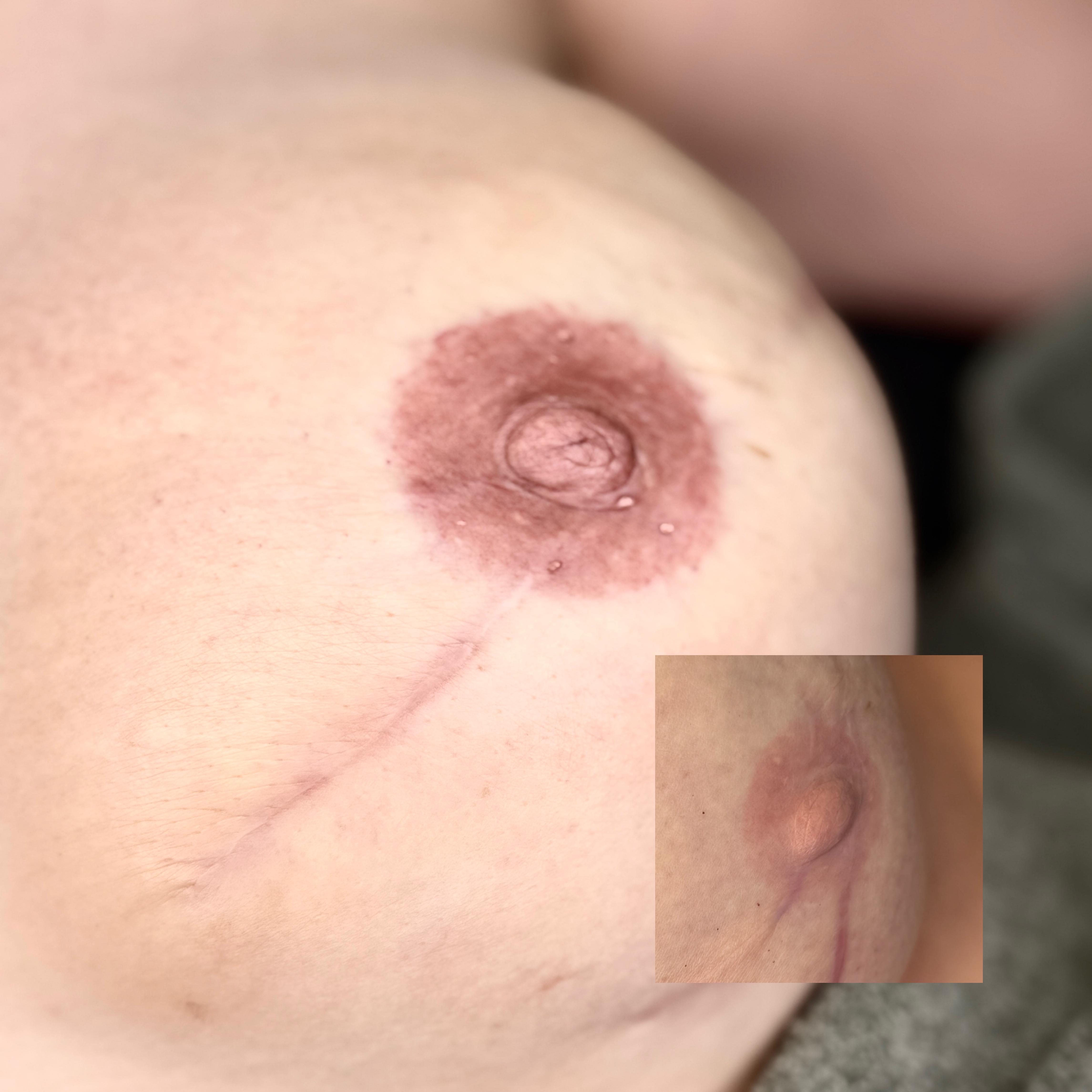 Wat is een areola / tepelhoftatoeage?